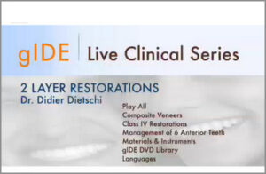 2 Layer Restorations: Composite Veneers, Class IV Restorations, Materials & Instruments