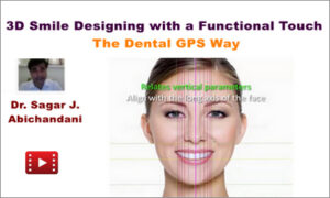 3D Smile Designing with a Functional Touch: The Dental GPS Way