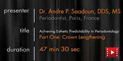 Crown Lengthening - Achieving Esthetic Predictability in Periodontology 1 Achieving Esthetic Predictability in Periodontology: Crown Lengthening
