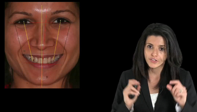 Aesthetic Treatment Planning: The Smile Design 3 Aesthetic Treatment Planning: The Smile Design - Image 3