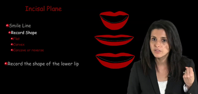 Aesthetic Treatment Planning: The Smile Design 4 Aesthetic Treatment Planning: The Smile Design - Image 4