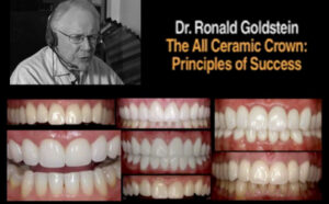 All Ceramic Crown: Principles of Success