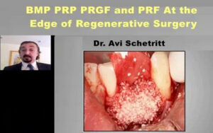 BMP, PRP, PRGF and PRF; At the Edge of Regenerative Surgery