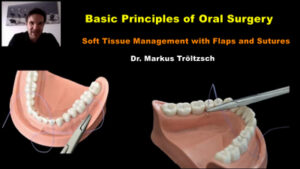 Basic Principles of Oral Surgery: Soft Tissue Management with Flaps and Sutures