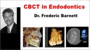 CBCT in Endodontics