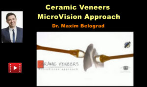 Ceramic Veneers: The MicroVision Approach