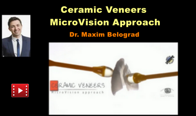 Ceramic Veneers: The MicroVision Approach 1 Ceramic Veneers: The MicroVision Approach
