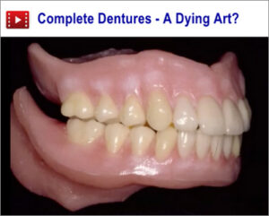 Complete Dentures: A Dying Art