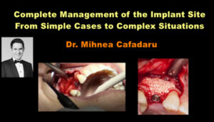 Complete Management of the Implant Site