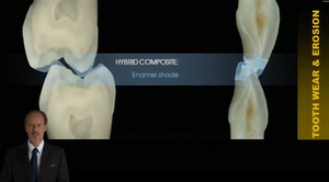 Conservative Rehabilitation of Abrasion & Erosion Cases 2 Conservative Rehabilitation of Abrasion & Erosion Cases