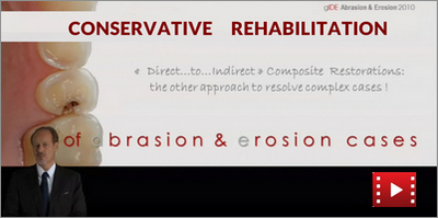 Conservative Rehabilitation of Abrasion & Erosion Cases 1 Conservative Rehabilitation of Abrasion & Erosion Cases