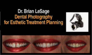 Dental Photography for Esthetic Treatment Planning