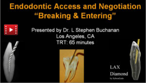 Endodontic Access and Negotiation