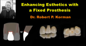 Enhancing Esthetics with a Fixed Prosthesis