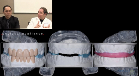Esthetic Rehabilitation for Severe Worn Dentition 2 Esthetic Rehabilitation for Severe Worn Dentition - Image 2