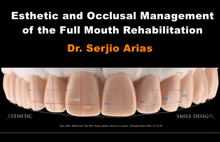Esthetic and Occlusal Management of the Full Mouth Rehabilitation 1 Esthetic and Occlusal Management of the Full Mouth Rehabilitation