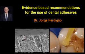 Evidence-Based Recommendations For The Use of Dental Adhesives