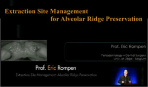 Extraction Site Management for Alveolar Ridge Preservation