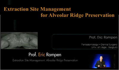 Extraction Site Management For Alveolar Ridge Preservation - Dental Videos