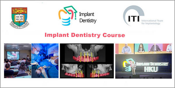 Implant Dentistry Course (The University of Hong Kong) 1 Implant Dentistry Course (The University of Hong Kong)
