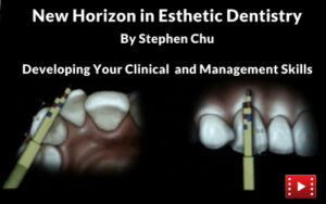 New Horizon in Esthetic Dentistry