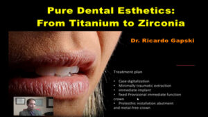 Pure Dental Esthetics: From Titanium to Zirconia