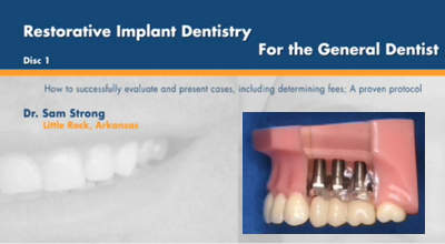 Restorative Implant Dentistry For the General Dentist (8 Videos) 1 Restorative Implant Dentistry For the General Dentist