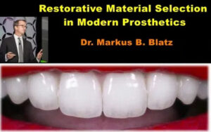Restorative Material Selection in Modern Prosthetics