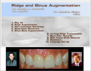 Ridge and Sinus Augmentation
