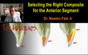 Selecting the Right Composite for the Anterior Segment