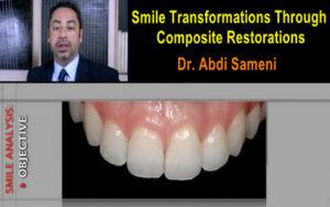 Smile Transformations Through Composite Restorations