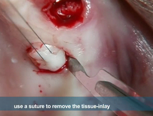 Advanced Implant Therapy: Soft Tissue Management 2 Advanced Implant Therapy: Soft Tissue Management - Image 2