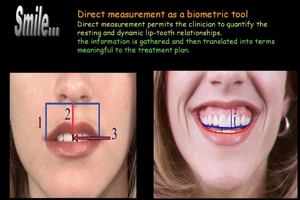 The Art of The Smile: From Diagnosis to Individualized Multidisciplinary Treatment Plan 3 The Art of The Smile: From Diagnosis to Individualized Multidisciplinary Treatment Plan - Image 3