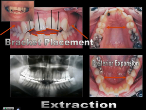 The Art of The Smile: From Diagnosis to Individualized Multidisciplinary Treatment Plan 4 The Art of The Smile: From Diagnosis to Individualized Multidisciplinary Treatment Plan - Image 4