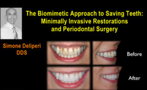 The Biomimetic Approach to Saving Teeth