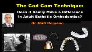 The CAD/CAM Technique and Orthodontics
