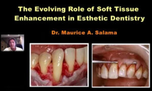 Soft Tissue Enhancement in Esthetic Reconstructive Dentistry