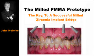The Milled PMMA Prototype