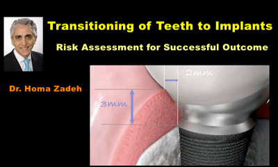 Transitioning of Teeth to Implants: Risk Assessment for Successful Outcome 1 Transitioning of Teeth to Implants: Risk Assessment for Successful Outcome