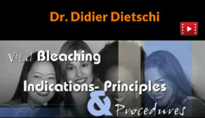 Vital Bleaching: Indications, Principles & Procedures
