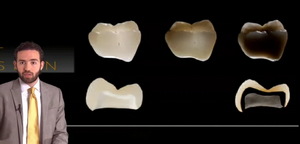 Which Ceramic Should I Use? A Clinical Perspective
