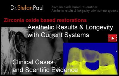 Zirconia Based Restorations for Esthetic Results and Longevity 1 Zirconia Based Restorations for Esthetic Results and Longevity
