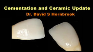 Cementation and Ceramic Update