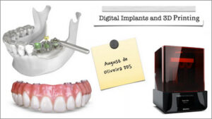 Digital Implantology and 3D Printing