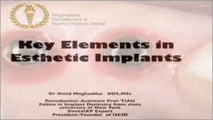 Esthetic Key Points in Minimizing Complications in Immediate Implants