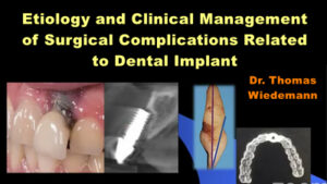 Etiology and Clinical Management of Surgical Complications Related to Dental Implant Procedures
