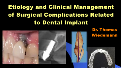 Etiology and Clinical Management of Surgical Complications Related to Dental Implant Procedures 1 Etiology and Clinical Management of Surgical Complications Related to Dental Implant Procedures