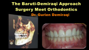 Predictable Functional Occlusion - Dental Videos