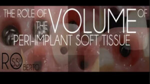 The Role Of The Volume Of Soft Tissue Around Implants