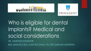 Who is Eligible for Dental Implants Medical and Social Consideration